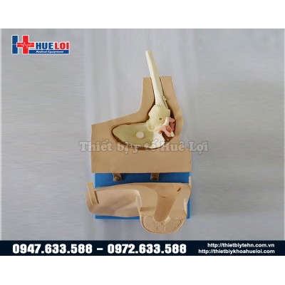 MÔ HÌNH ĐÀO TẠO PHẪU THUẬT NỘI SOI KHỚP VAI